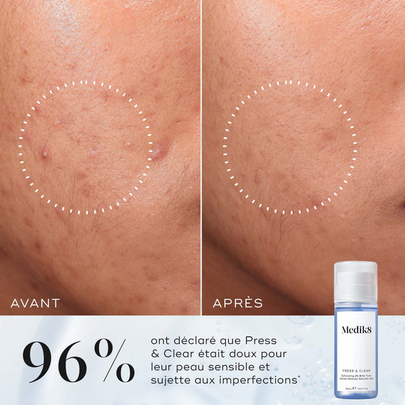 Press & Clear ™ hover