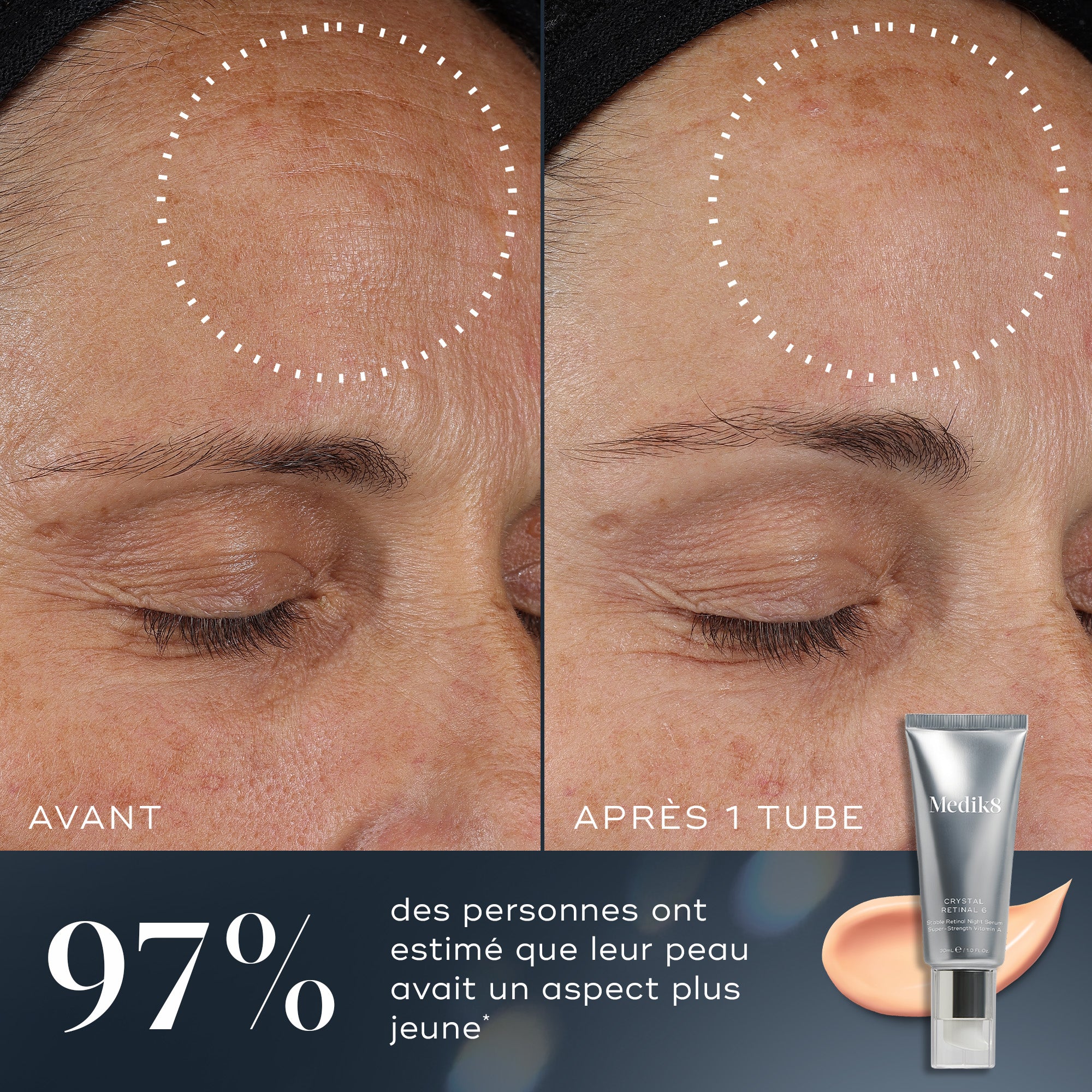 Crystal Retinal® 1/3/6/10/20/24 | Vitamin A Serum 0.01-0.24