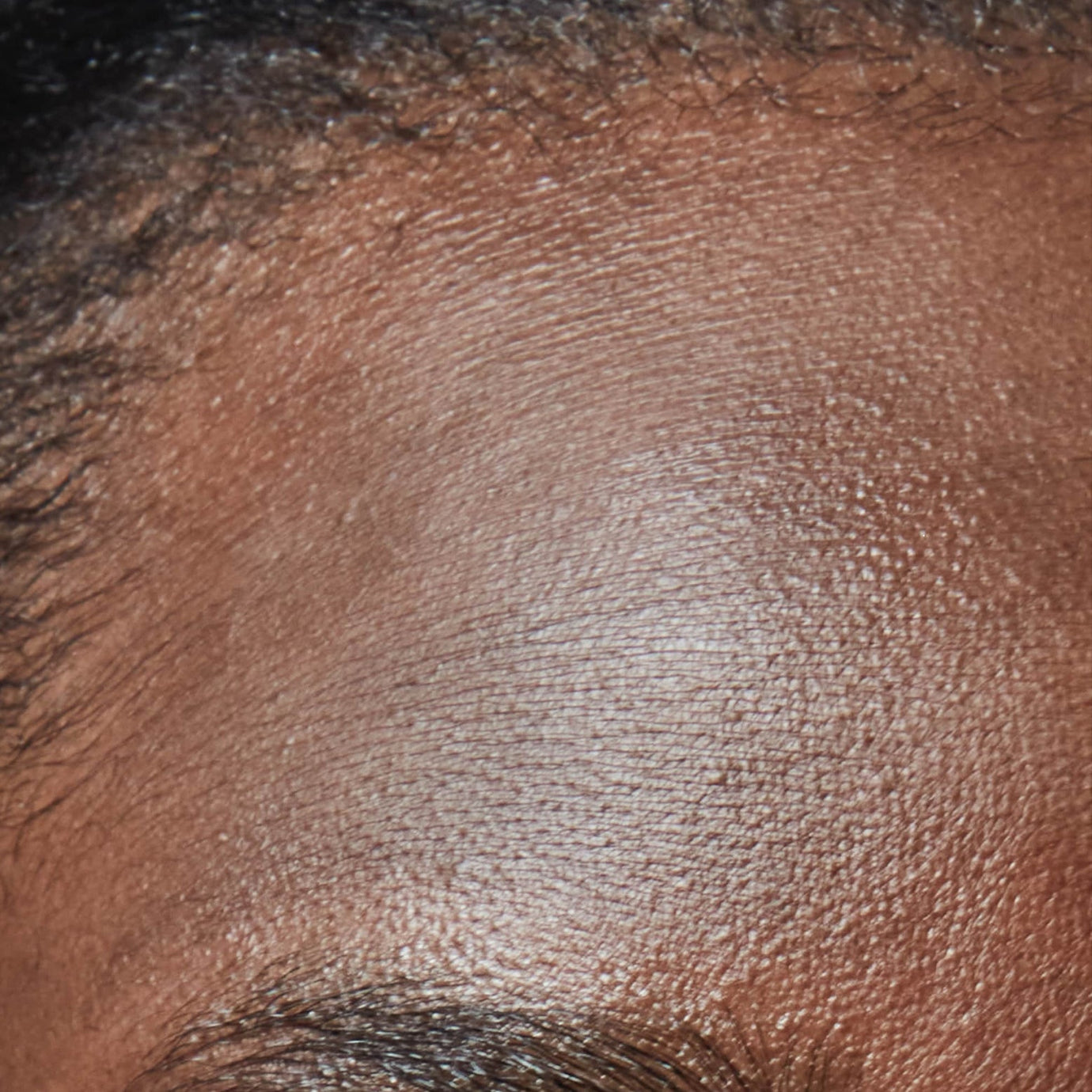 Normal to Dry Skin: