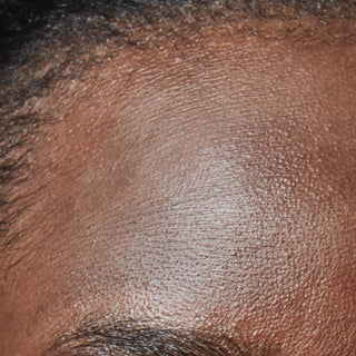 Une prise de vue macro centrée sur le front juste au-dessus du sourcil. La peau aux tons foncés présente une texture fine et marquée composée de nombreuses lignes horizontales de déshydratation rapprochées, donnant un aspect légèrement tendu ou desséché malgré un léger éclat en surface.