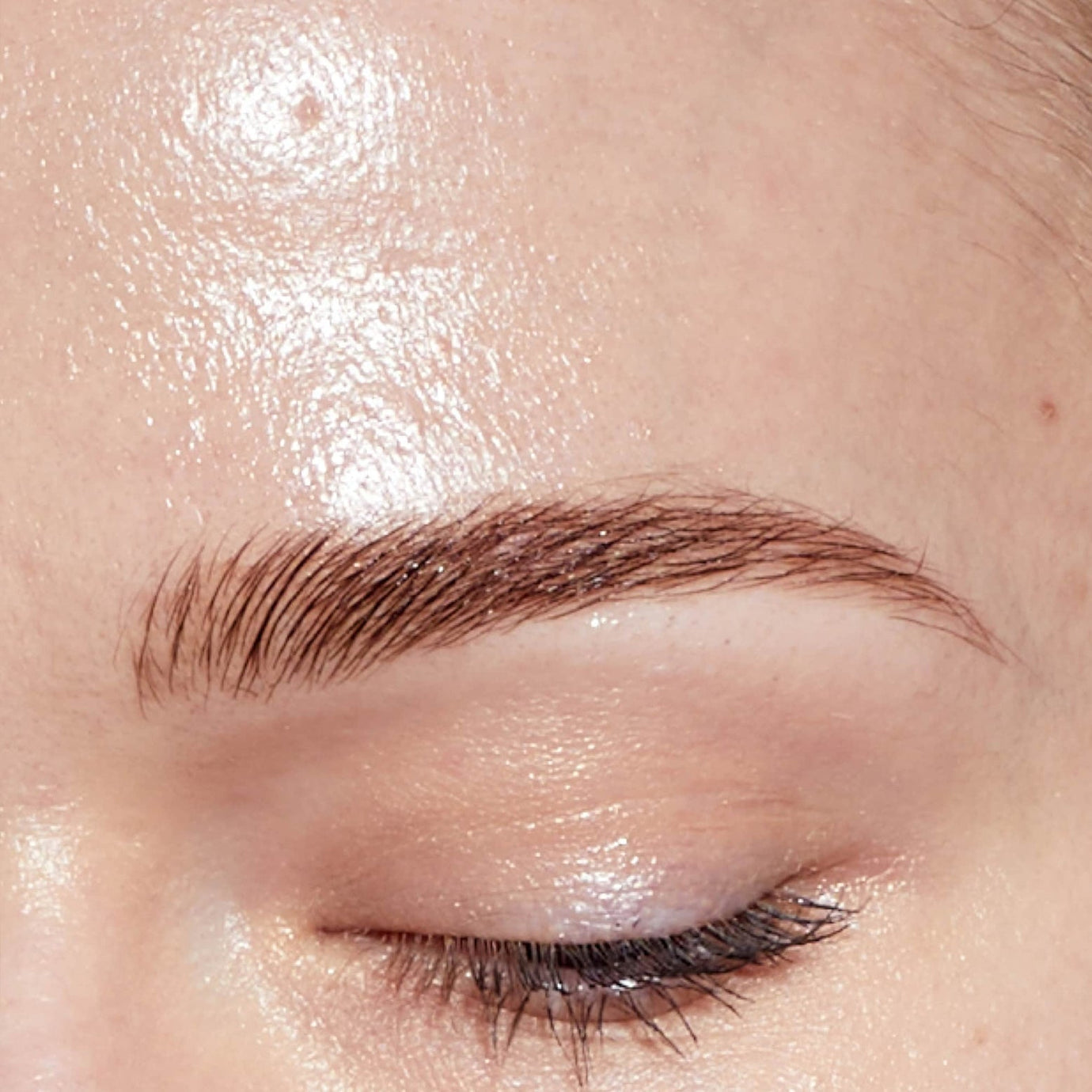 Oily and Congested Skin: