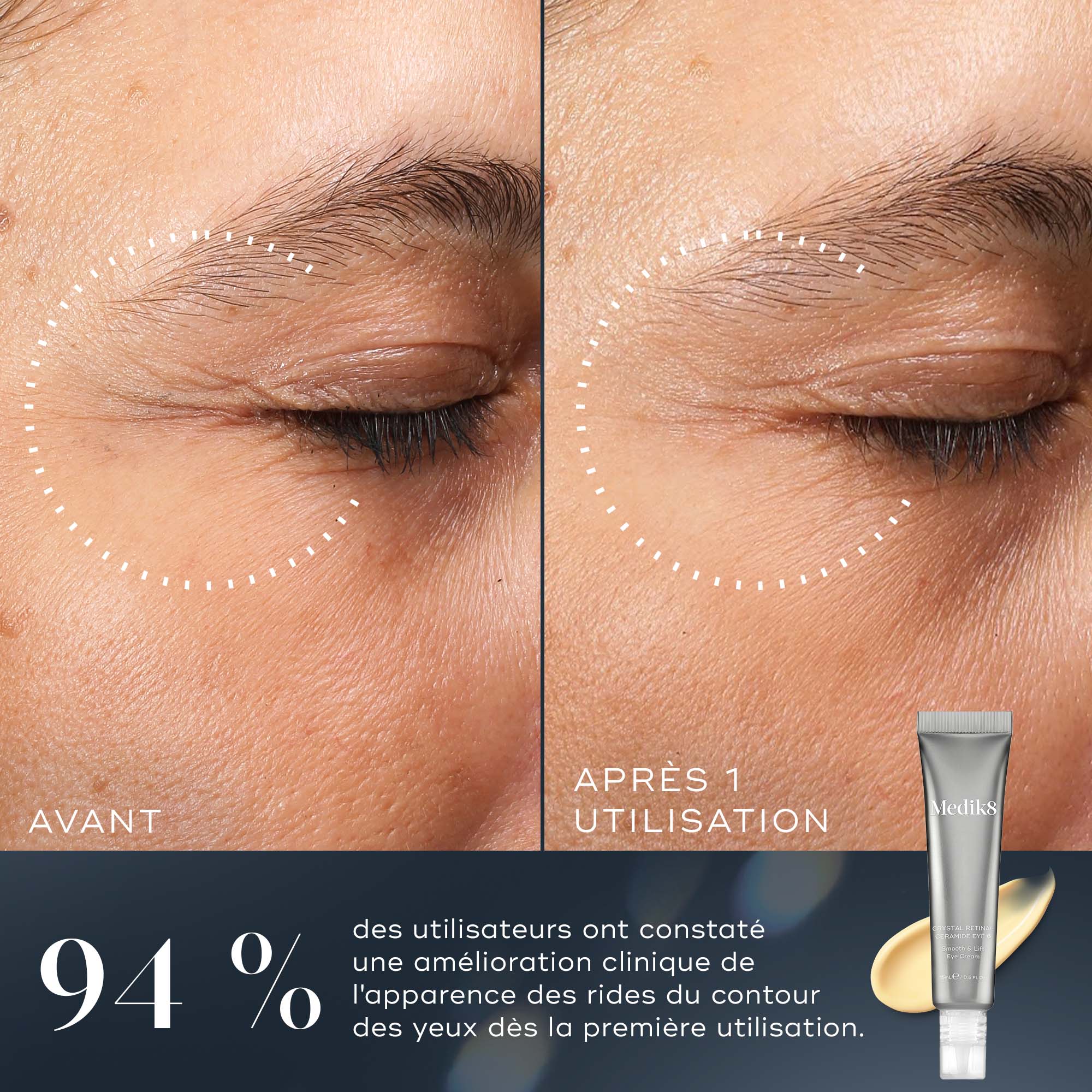 Crystal Retinal Ceramide Eye | Vitamin A Serum – Medik8-FR