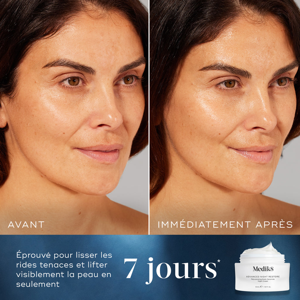 Advanced Night Restore ™