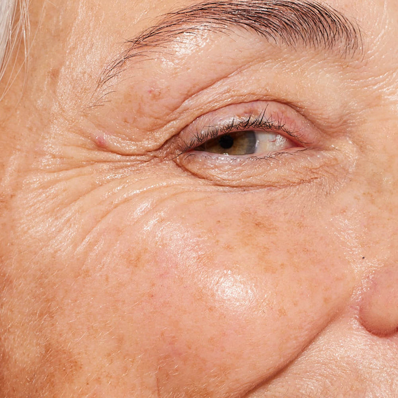 Mature Skin: