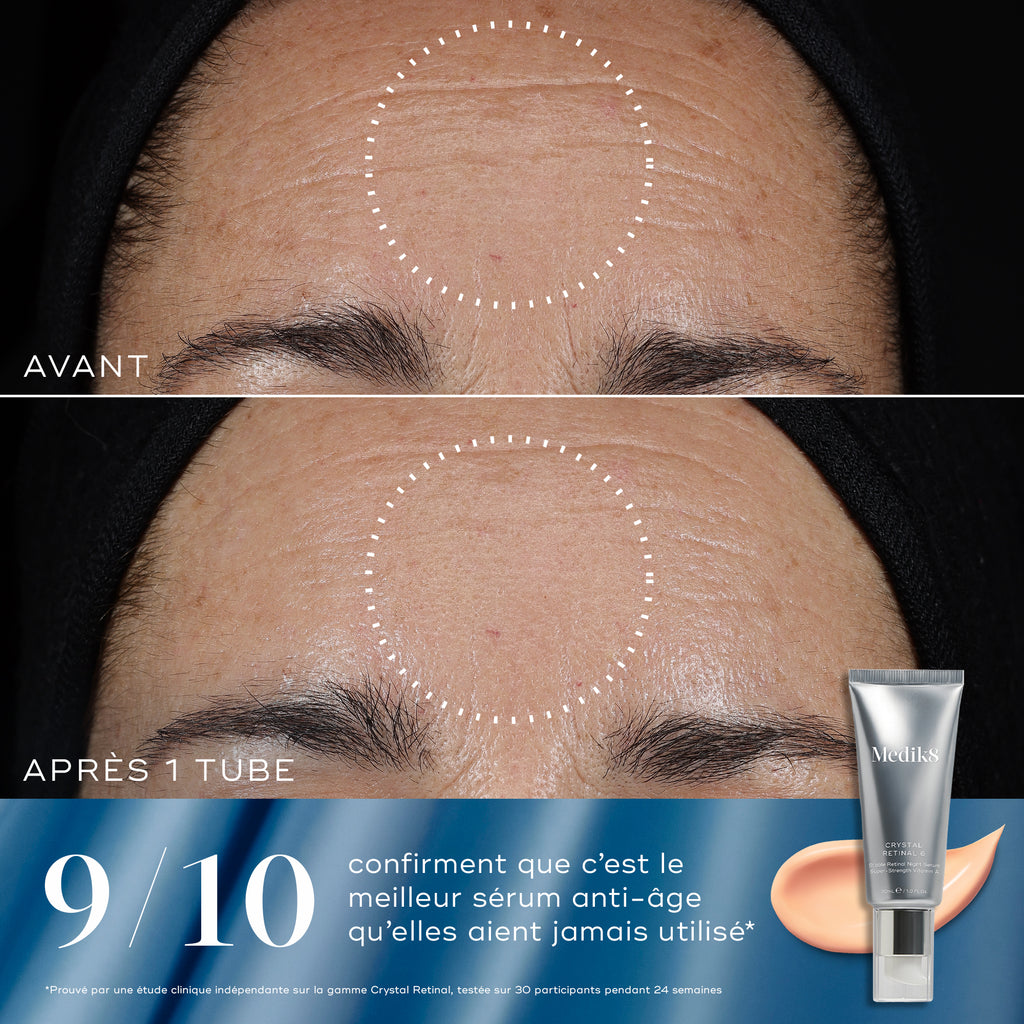 Rejuvenation Reset