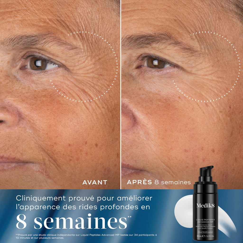 Rejuvenation Reset
