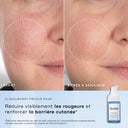 Before and after comparison of skin with redness, featuring Medik8 skincare product.