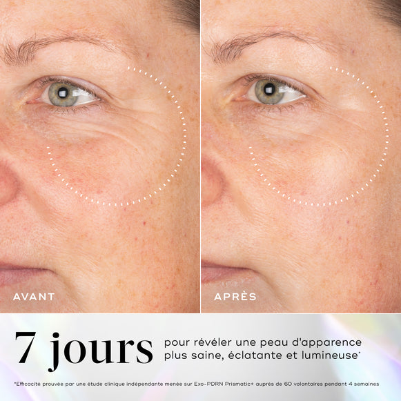Images avant-après de la zone du regard montrant une amélioration de la vitalité et de la luminosité de la peau après 7 jours d'utilisation du Medik8 Exo-PDRN Prismatic+.-hover-1