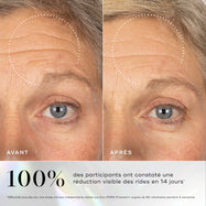 Images avant-après montrant des rides visibles sur le contour des yeux, avec une amélioration soulignée après l'utilisation du sérum Medik8 Exo-PDRN Prismatic+.