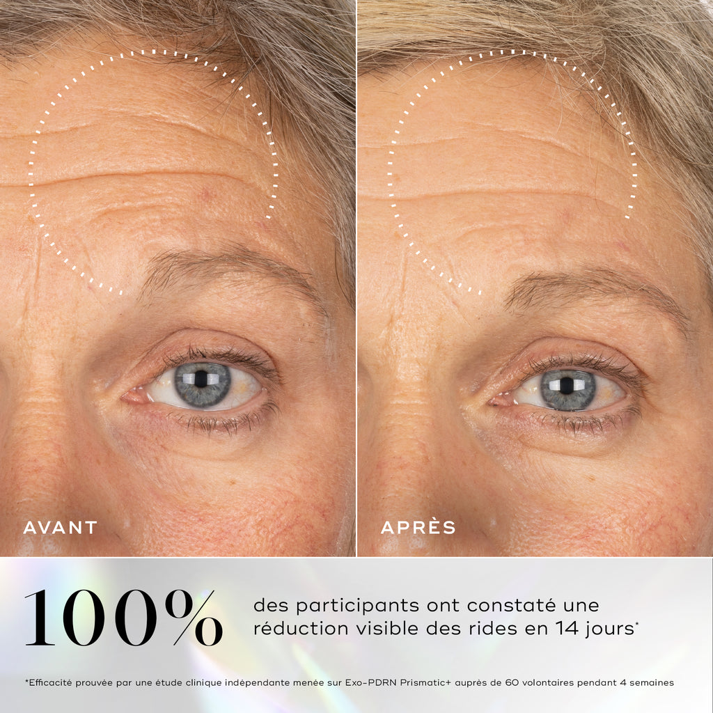 Images avant-après montrant des rides visibles sur le contour des yeux, avec une amélioration soulignée après l'utilisation du sérum Medik8 Exo-PDRN Prismatic+.